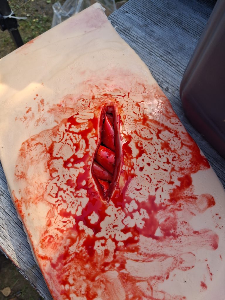 stomach wound