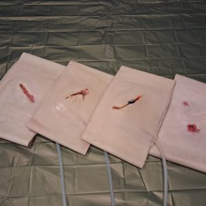 stab wound series